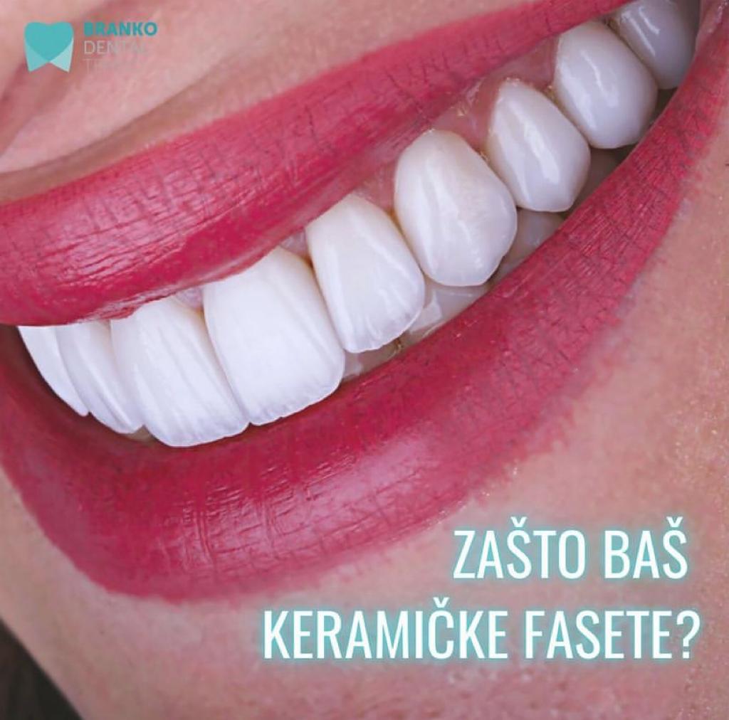 Keramičke fasete – Branko Dental