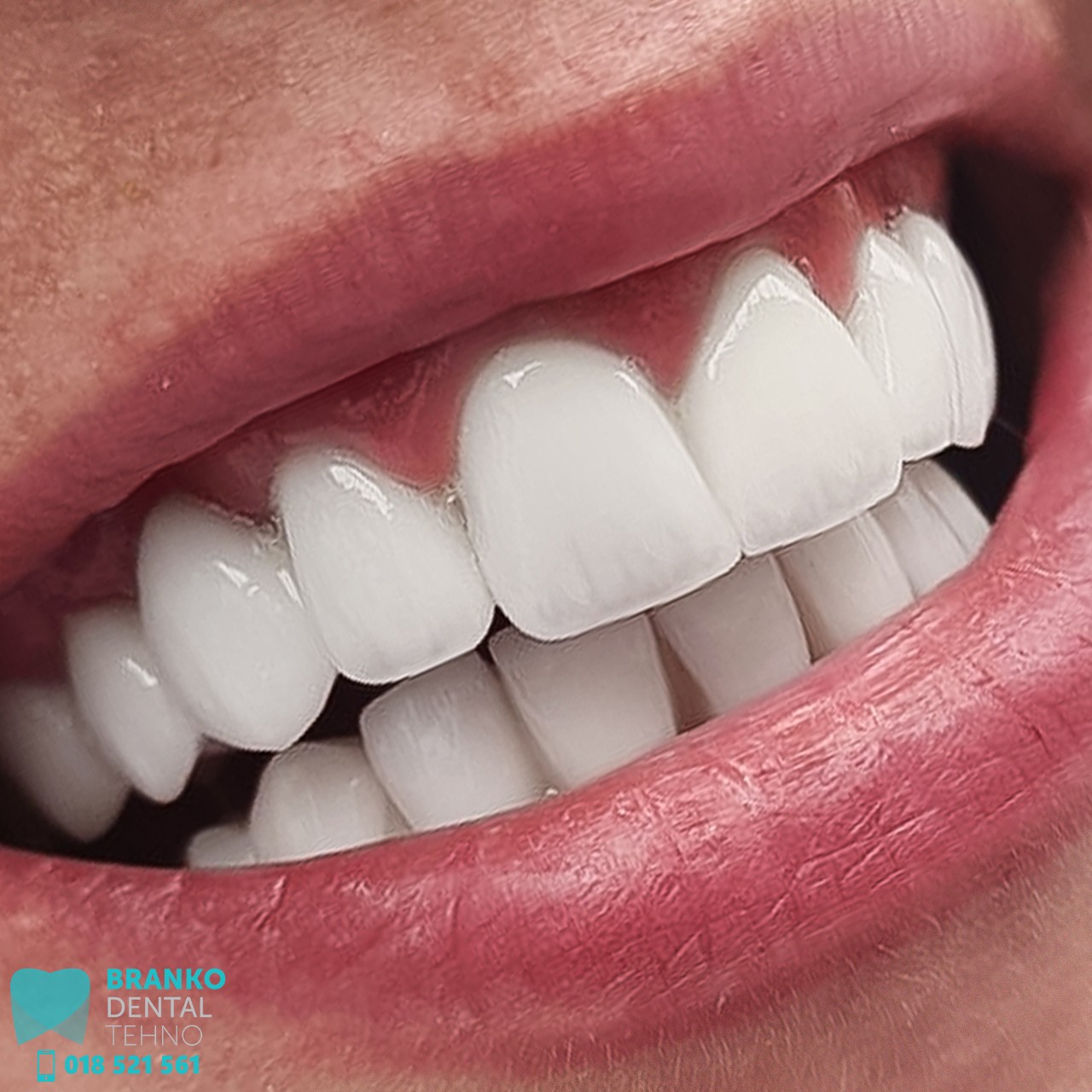 Branko dental (21)