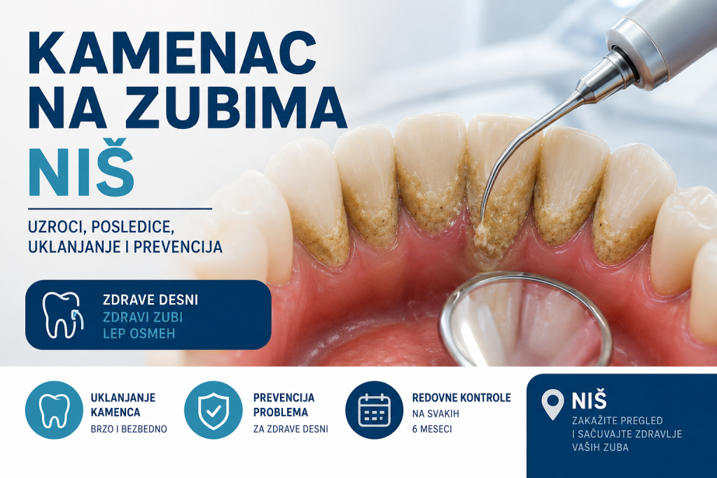Kamenac na zubima Branko dental