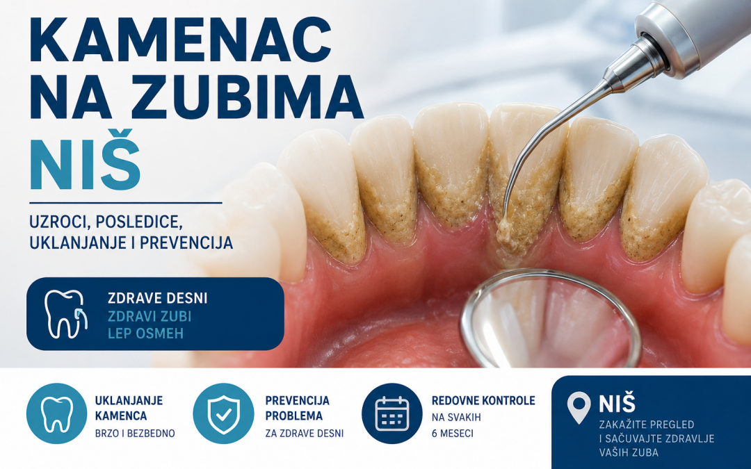 Kamenac na zubima Niš – kako nastaje, uklanjanje i cena