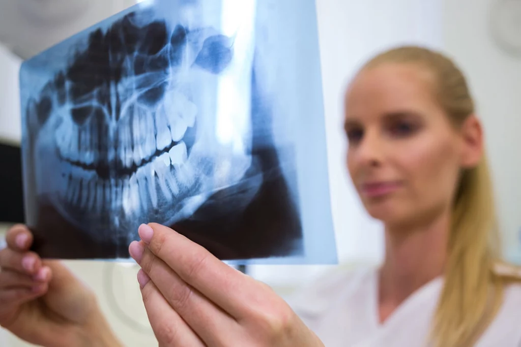 Stomatolog analizira panoramski rendgenski snimak vilice sa umnjacima – Branko Dental Tehno, Niš