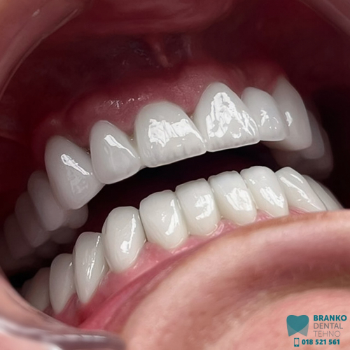 Branko dental (11)