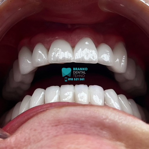 Branko dental (12)