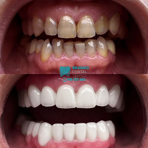 Branko dental (3)