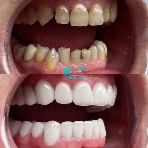 Branko dental (4)