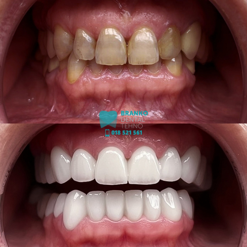 Branko dental (5)