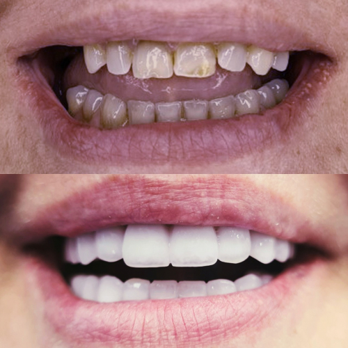 Smile Branko Dental